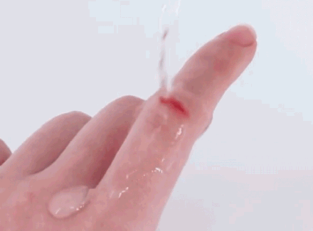 4种伤口不能用液体创可贴 4种伤口不能用液体创可贴