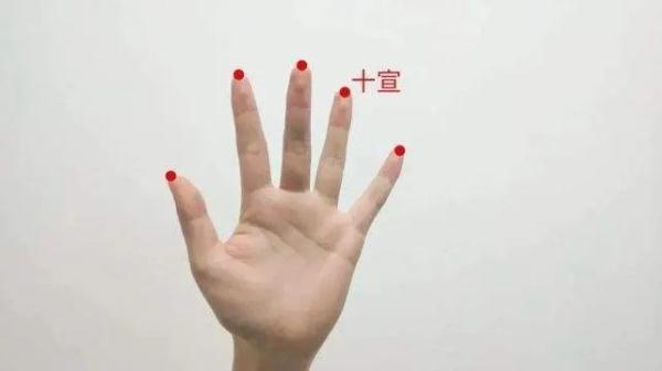 手麻都是因为颈椎病？还可能是这几种疾病