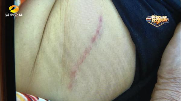 女子面试中被公司宠物狗咬伤?公司:她主动逗狗 女子面试中被公司宠物狗咬伤?公司:她主动逗狗