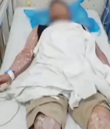被咬一口，广东一男子倒地休克！看到这种东西千万远离！