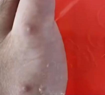 被咬一口,男子全身麻痹、倒地休克……看到它们,退!退!退! 被咬一口,男子全身麻痹、倒地休克……看到它们,退!退!退!