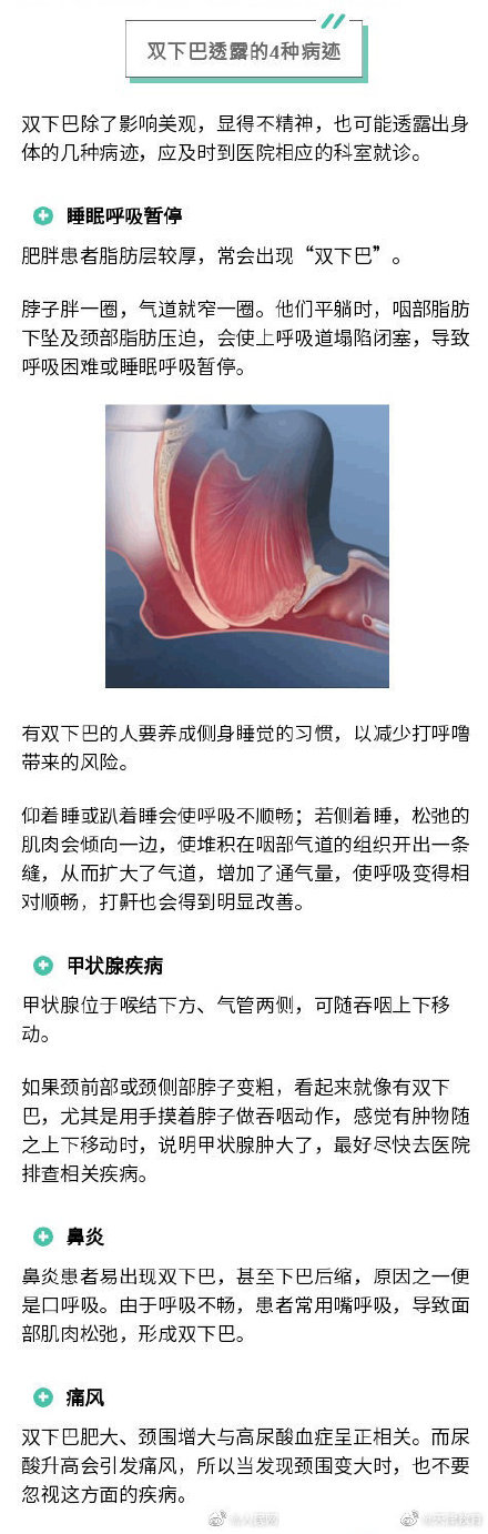 双下巴背后可能有4种病
