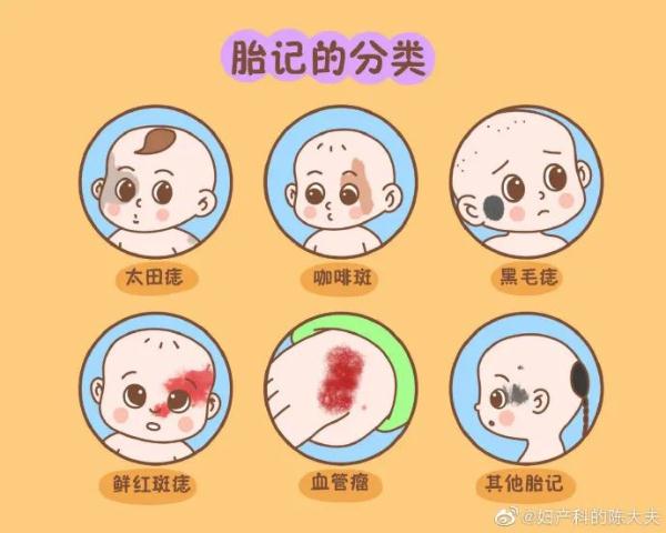 “腹中双胞胎打架，出生后浑身淤青”冲上热搜！这是真的吗？医生发声
