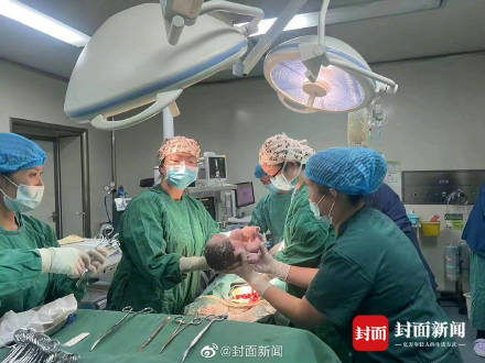 泸定震后首个宝宝降生 医生们都哭了…… 泸定震后首个宝宝降生 医生们都哭了……