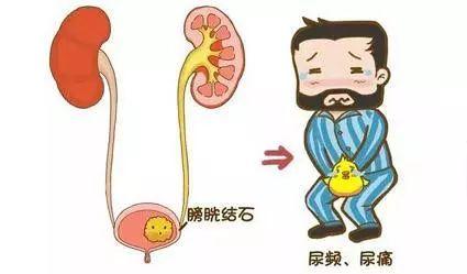 提醒！一老人“憋”得慌，原来是这个病！