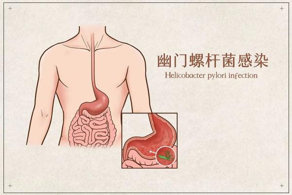 杭州一家人去查幽门螺旋杆菌，结果全都中招！网友说，他现在成了同事眼里的……