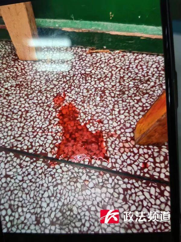 13岁男孩咯血4个月,医生一句话“治”好了 13岁男孩咯血4个月,医生一句话“治”好了