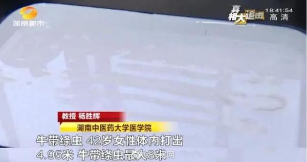 毛骨悚然！女子体内排出4.95米“长虫”