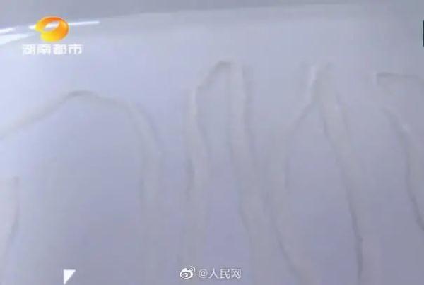 毛骨悚然！女子体内排出4.95米“长虫”
