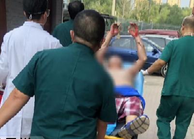 男子蹲马桶,突然炸了!全身80%烧伤!这个行为别不当回事... 男子蹲马桶,突然炸了!全身80%烧伤!这个行为别不当回事...