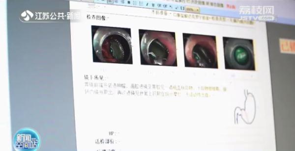 男子喝粥被异物卡喉硬吞馒头咽下，取出后发现竟是……