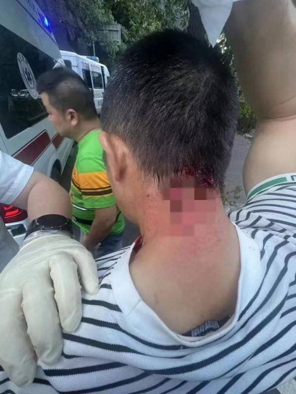 温州一男子泽雅游玩遭猴子袭击,后脖子被抓咬受伤,鲜血直流