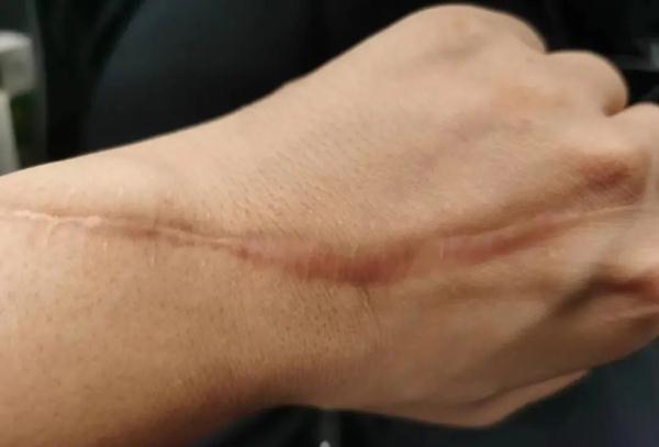 “那一刻，我与死亡就差一声枪响。”