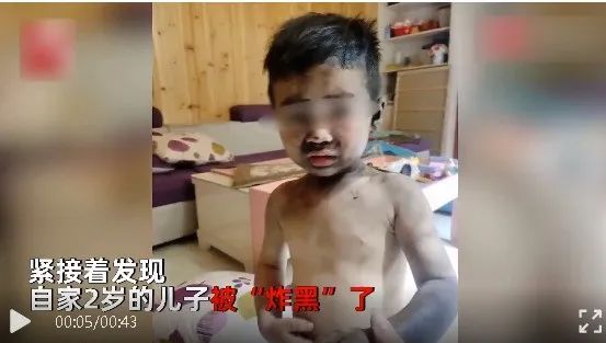 “砰”的一声！熊孩子被“炸黑”了