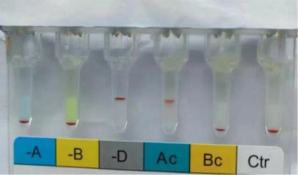 湖南长沙一孕妇就诊时测出“恐龙血” 医院：全国仅百余例 日常需格外注意自身健康