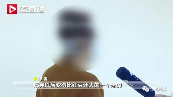 女子鼻子长疙瘩以为是黑头，医生一眼看出不对劲：是癌！