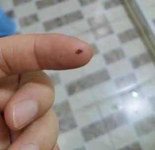 女子家里小飞虫泛滥,竟是因为前年冬天买了它!很多人家里都有 女子家里小飞虫泛滥,竟是因为前年冬天买了它!很多人家里都有