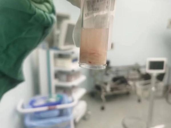 10岁小孩撸猫后反复发烧 身上肿出两大“鸡蛋”......