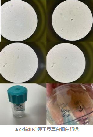 对OK镜卫生护理不当，13岁男孩眼睛感染阿米巴原虫差点视力不保