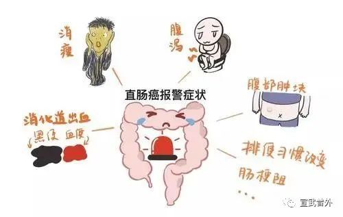 大便粘马桶，是肠癌预兆吗？