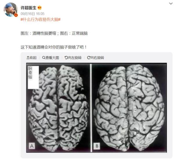 喝酒后，看看酒精对你的脑子做了什么？看完再也不要多碰了！