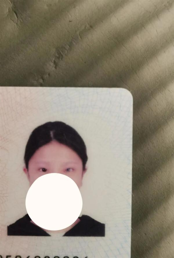 长沙18岁女孩一只眼天生蓝瞳，曾被视为异类！网友：她的眼睛将星海藏在眼底