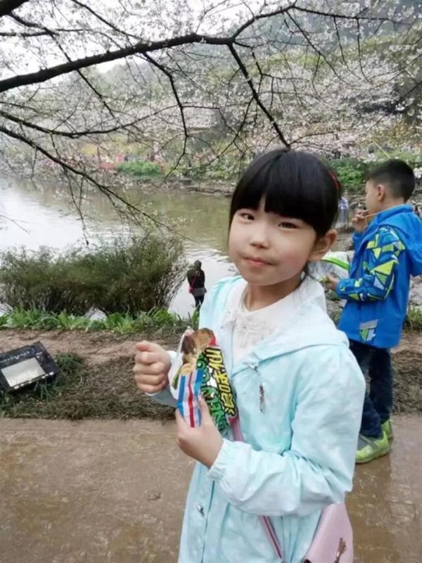 长沙18岁女孩一只眼天生蓝瞳，曾被视为异类！网友：她的眼睛将星海藏在眼底