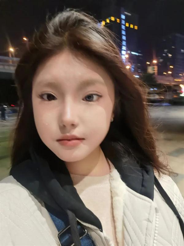 长沙18岁女孩一只眼天生蓝瞳，曾被视为异类！网友：她的眼睛将星海藏在眼底