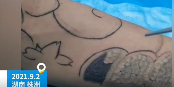 图啥!初中生花900元文身,清洗要6万 图啥!初中生花900元文身,清洗要6万