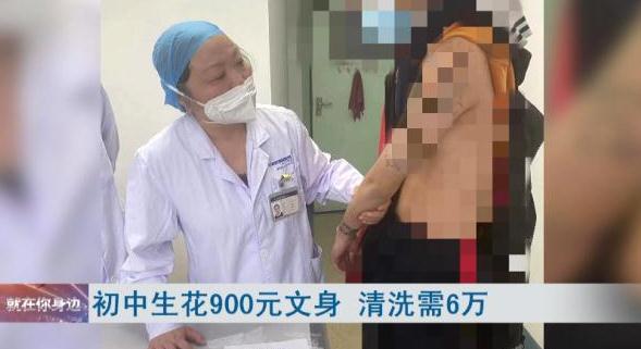 图啥!初中生花900元文身,清洗要6万 图啥!初中生花900元文身,清洗要6万