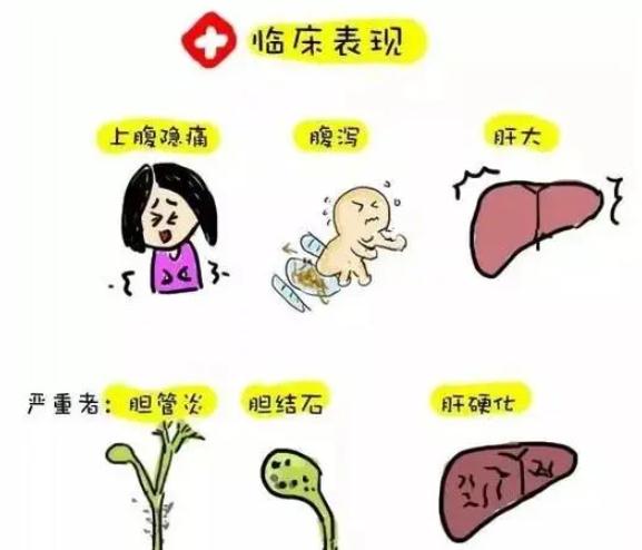 杭州男子咳嗽不止...小心!这个东西会“吃掉”你的肝 杭州男子咳嗽不止...小心!这个东西会“吃掉”你的肝