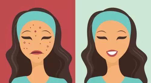 【医聊】拿什么拯救你，我的痘痘肌？