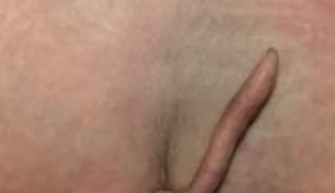 墨西哥1名女婴出生,屁股长了5.7厘米“小尾巴” 墨西哥1名女婴出生,屁股长了5.7厘米“小尾巴”