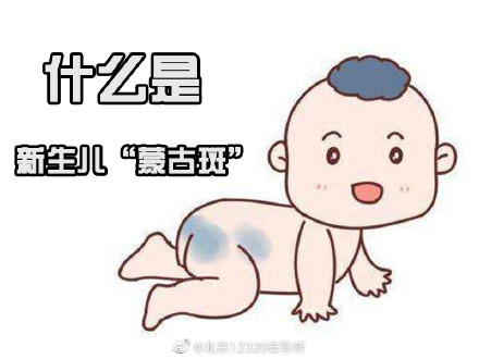 新生儿的蒙古斑是怎么回事?