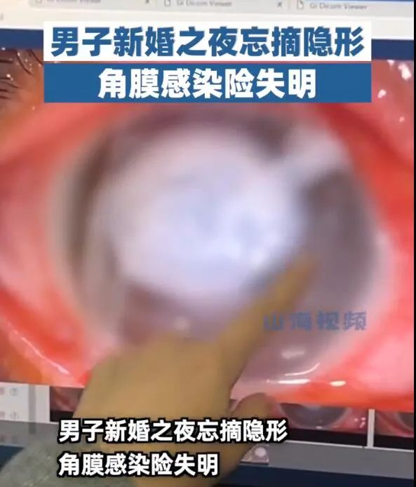 男子新婚夜,眼球变白险失明 男子新婚夜,眼球变白险失明