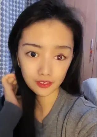90后女孩失去右眼后自学成为义眼师：只想为更多单眼群体找回自信的力量