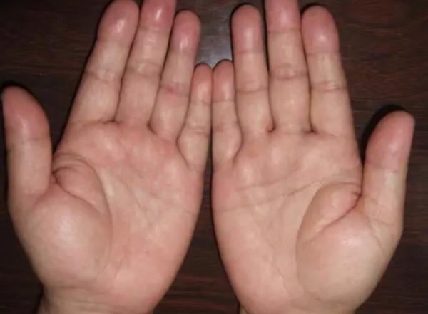 气血不足人易老！一个简单小动作，就能补气又养血！