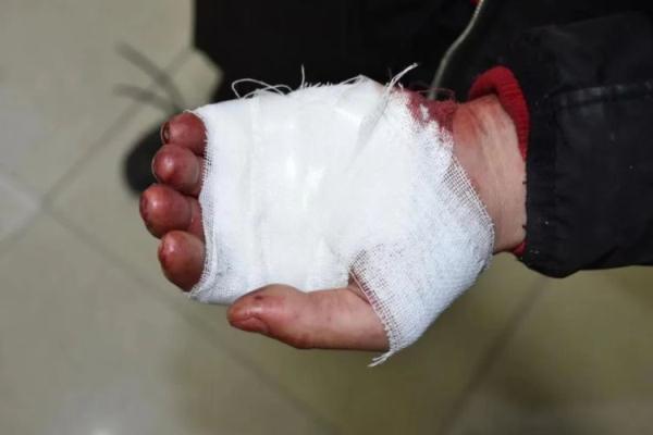 一男子被3人持刀抢劫?警方一查发现另有猫腻!