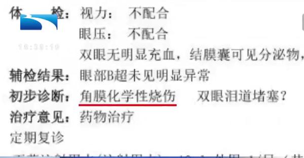 这样的粗心太可怕!28天女婴差点失去双眼... 这样的粗心太可怕!28天女婴差点失去双眼...