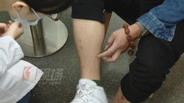 “阳了”之后，不能戴隐形眼镜？医生这么说…
