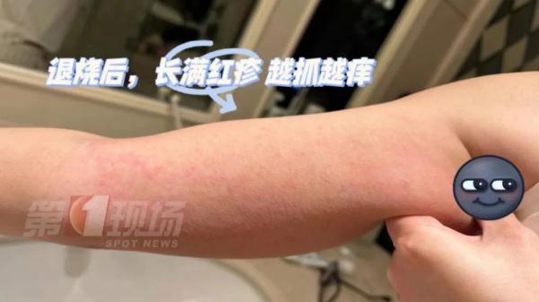 “阳了”之后，不能戴隐形眼镜？医生这么说…