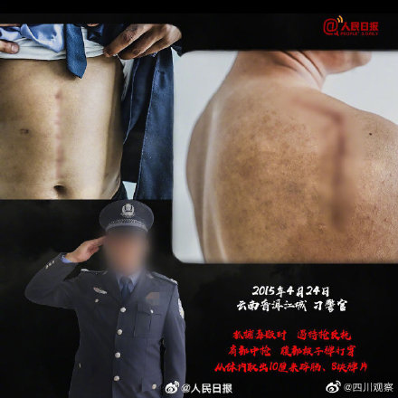 这些禁毒民警的伤疤不能忘！