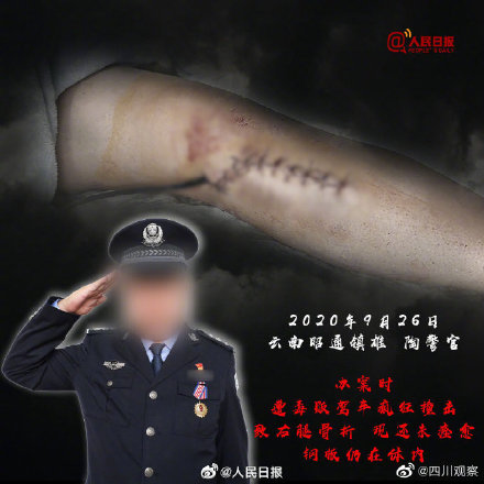 这些禁毒民警的伤疤不能忘！