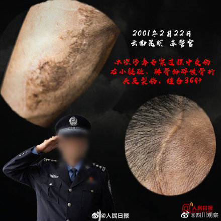 这些禁毒民警的伤疤不能忘！