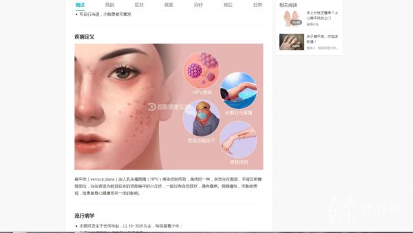 美容美发店治“扁平疣”？小伙两个月花了34万余元