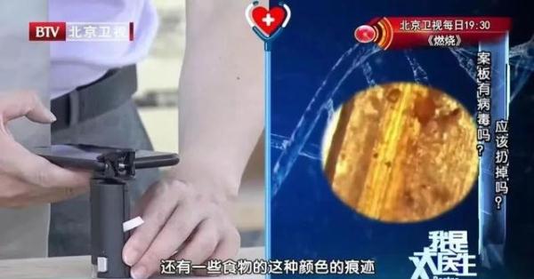 740万个细菌!厨房里这4样东西都是“细菌窝”,再省也要定期换,否则疾病“找上门” 740万个细菌!厨房里这4样东西都是“细菌窝”,再省也要定期换,否则疾病“找上门”
