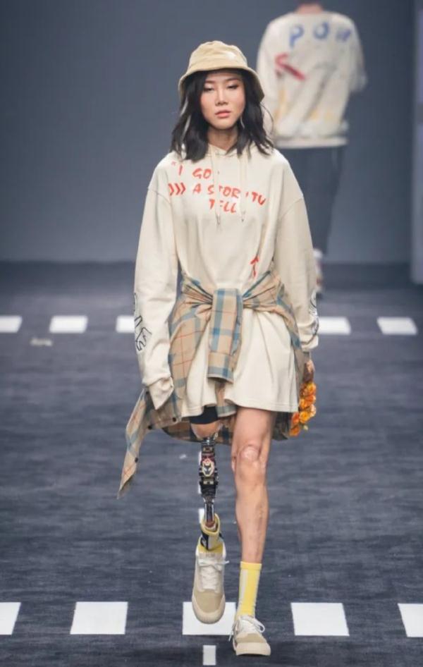 “闪光假肢”女孩，有新身份