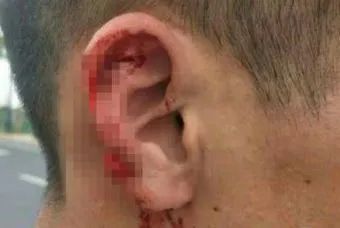 警方提醒，这种情况建议主动报警！