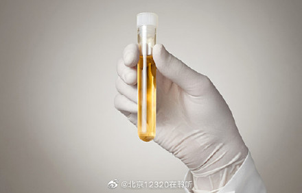 尿检时，晨尿和随机尿留取哪个好？