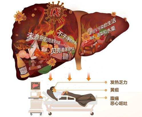 全球三分之一的人感染过!被忽视的“戊肝”该如何防治? 全球三分之一的人感染过!被忽视的“戊肝”该如何防治?